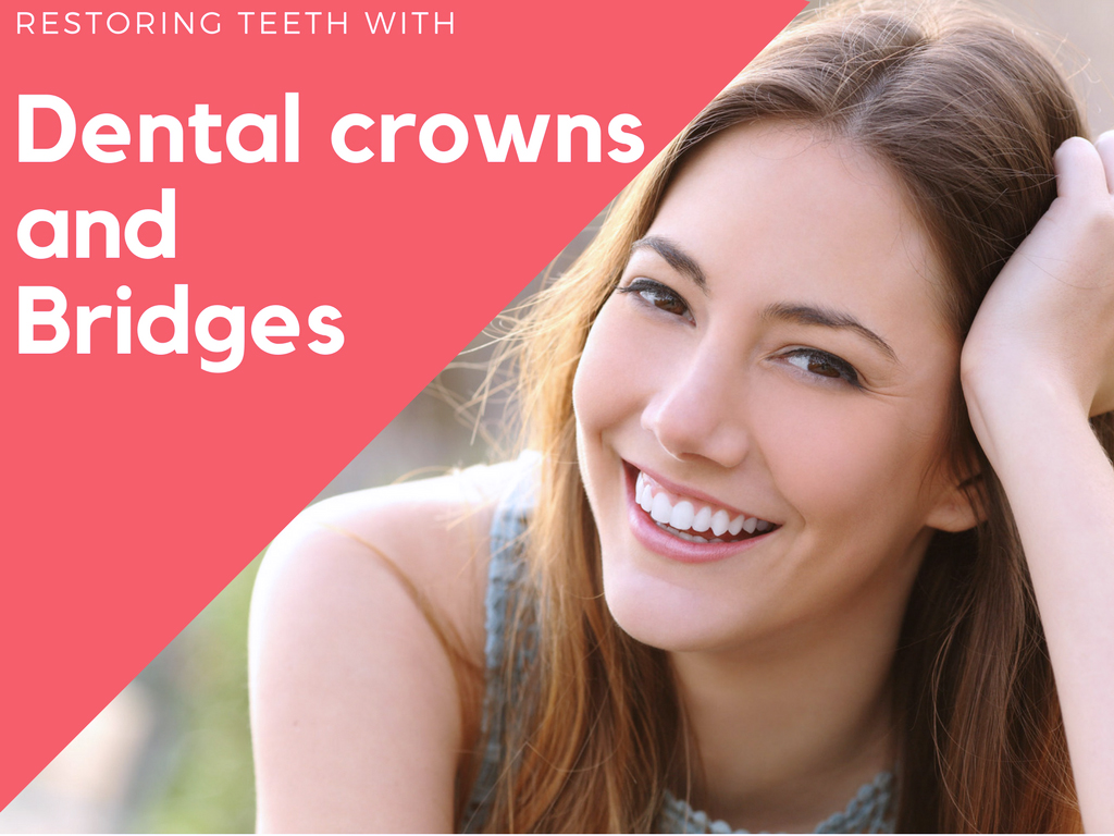 In Tijuana and Mexico we specialize in Crown and bridge work. Crown and bridges are fixed to existing teeth or implants.