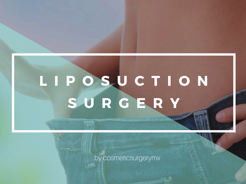 Liposuction Surgery to Sculpt Your Figure in Tijuana, Mexico