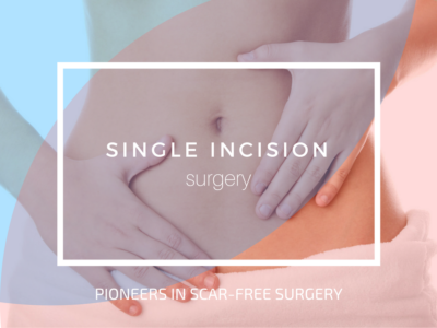 Single Y Incision Single Incision Laparoscopic Surgery | Single-port Access Surgery