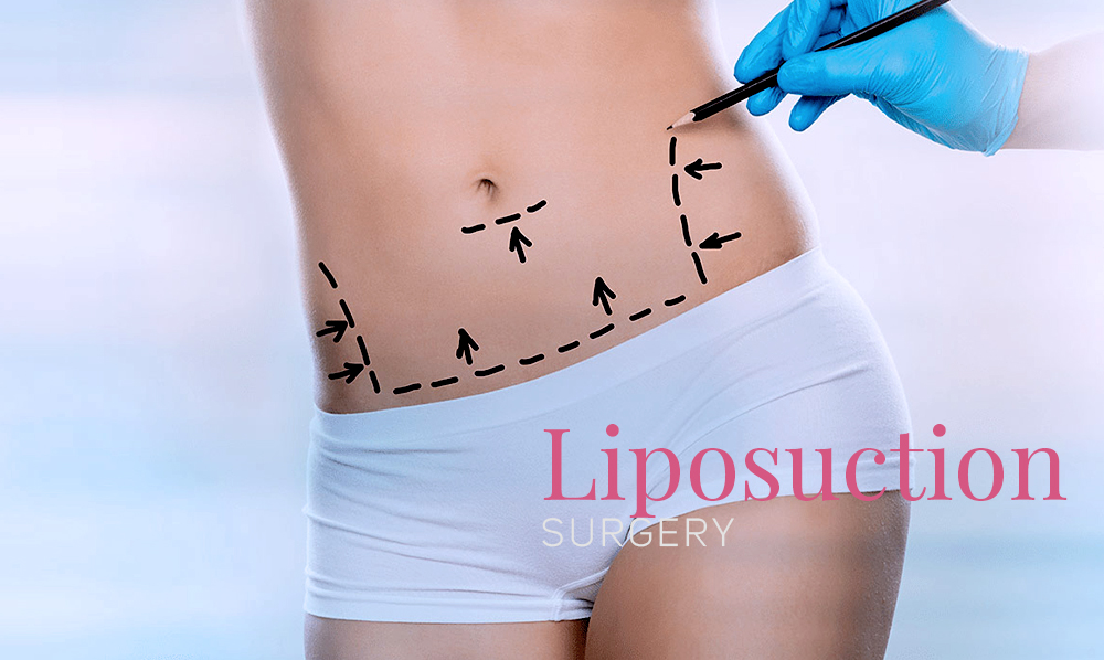 Plastic Surgery Tijuana, founded by Dr. Rafael Camberos, offers liposuction surgery.