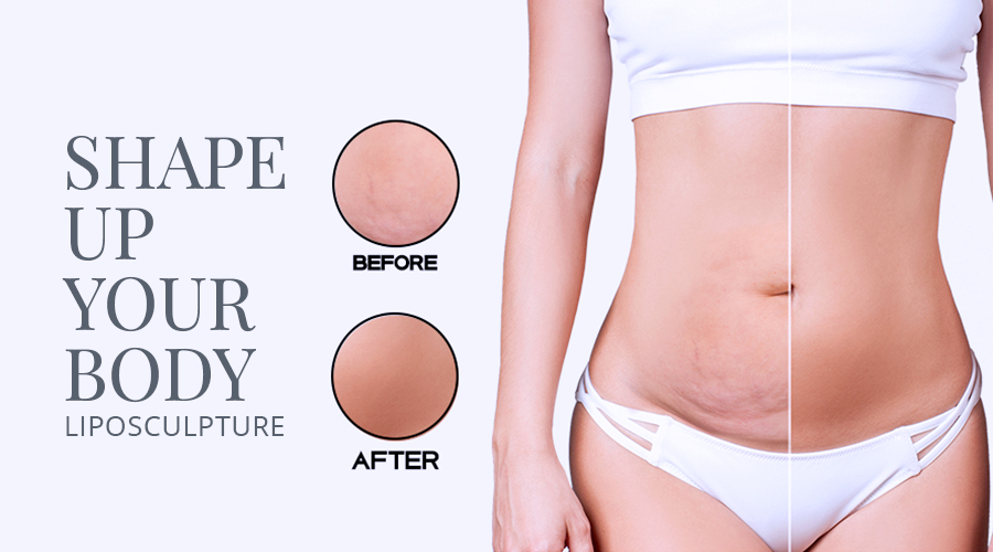 Plastic Surgery Tijuana, founded by Dr Rafael Camberos, offers liposculpture.