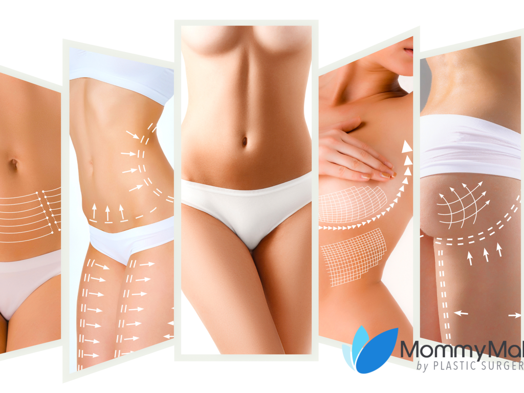 Get your pre-baby body back with a mommy makeover, from Plastic Surgery Tijuana tailored to you.