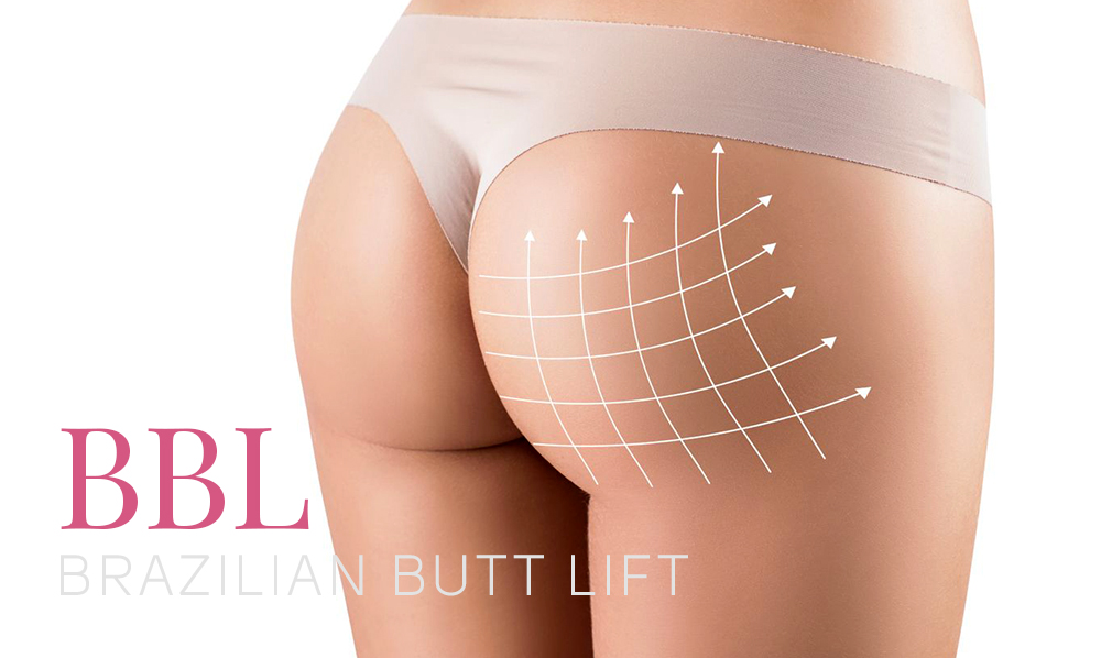 The Brazilian Butt Lift Surgery (BBL) is a buttock augmentation procedure that uses unwanted fat from other parts of the body to lift and add volume to the buttocks.