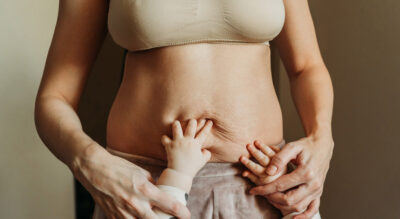 In Mexico, a mommy makeover costs might fall between $6,000 and $14,000. The cost includes anesthesia, operating room, and recovery garments.